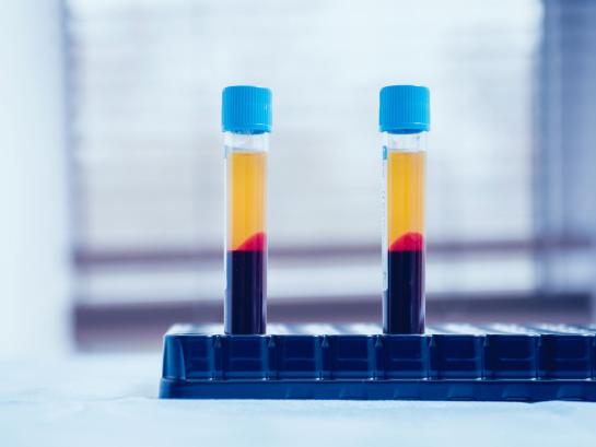 Platelet Rich Plasma