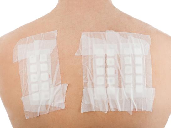 plaktest dermatologie